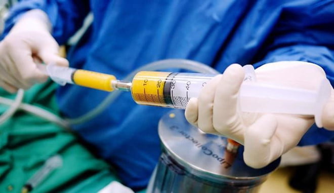 Nâng mũi, sửa mũi, sửa mũi hỏng-5