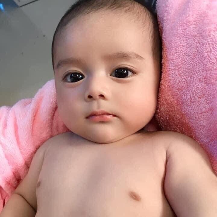 Mũi cao từ gen di truyền