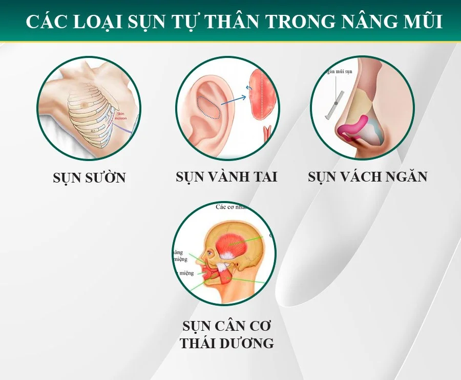 Nâng mũi, sửa mũi, sửa mũi hỏng-7
