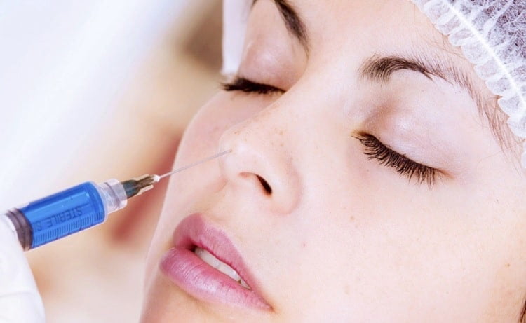 Nâng mũi, sửa mũi, sửa mũi hỏng-4