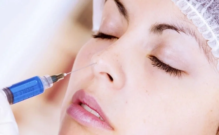 Nâng mũi, sửa mũi, sửa mũi hỏng-4