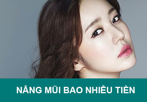 Nâng mũi, sửa mũi, sửa mũi hỏng-10