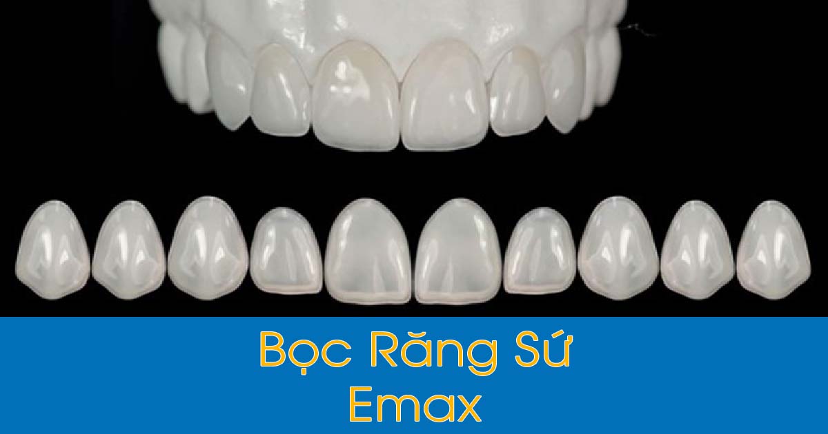 Bọc răng sứ Emax