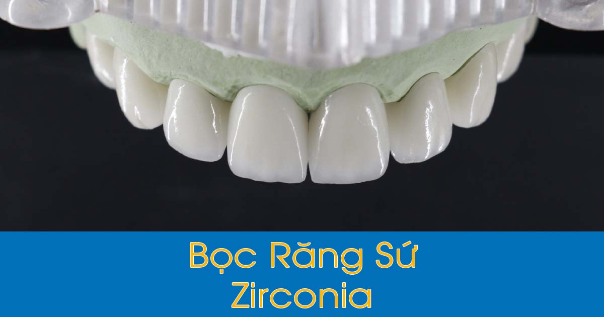 Bọc răng sứ Zirconia