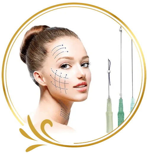 Phẫu thuật thẩm mỹ căng chỉ collagen
