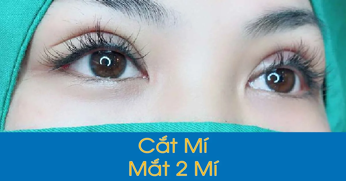 Cắt Mí mini deep