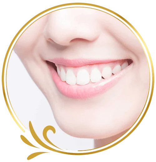 Dán Sú Veneer