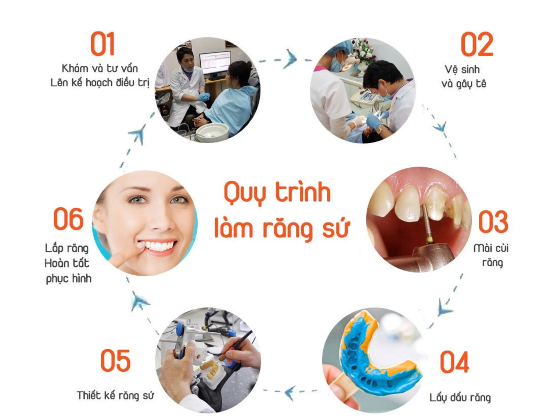 hậu quả bọc răng sứ giá rẻ