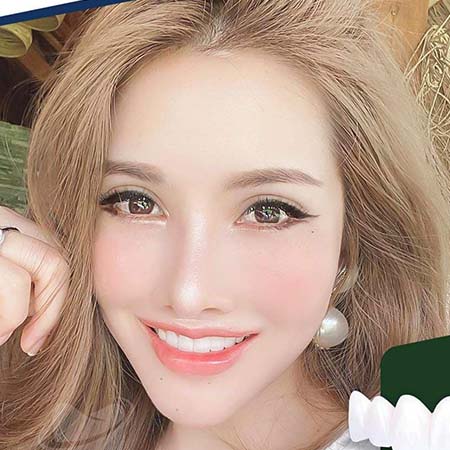 Khách hàng nha khoa thẩm mỹ Smile Dental 1