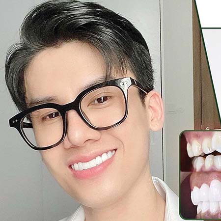 Khách hàng nha khoa thẩm mỹ Smile Dental 3