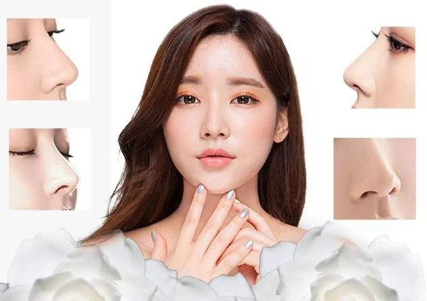 đôi nét về nâng mũi cấu trúc