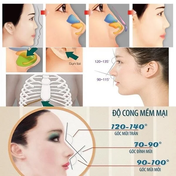 các dạng nâng mũi cấu trúc
