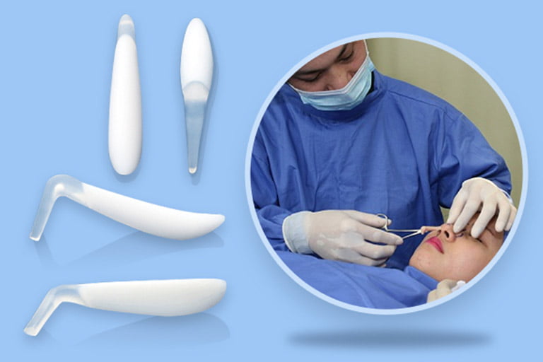 Nâng mũi, sửa mũi, sửa mũi hỏng-6