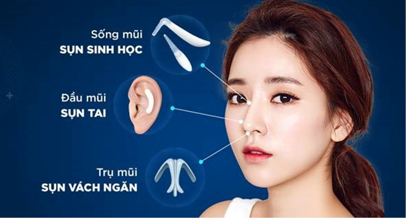 Nâng mũi, sửa mũi, sửa mũi hỏng-9