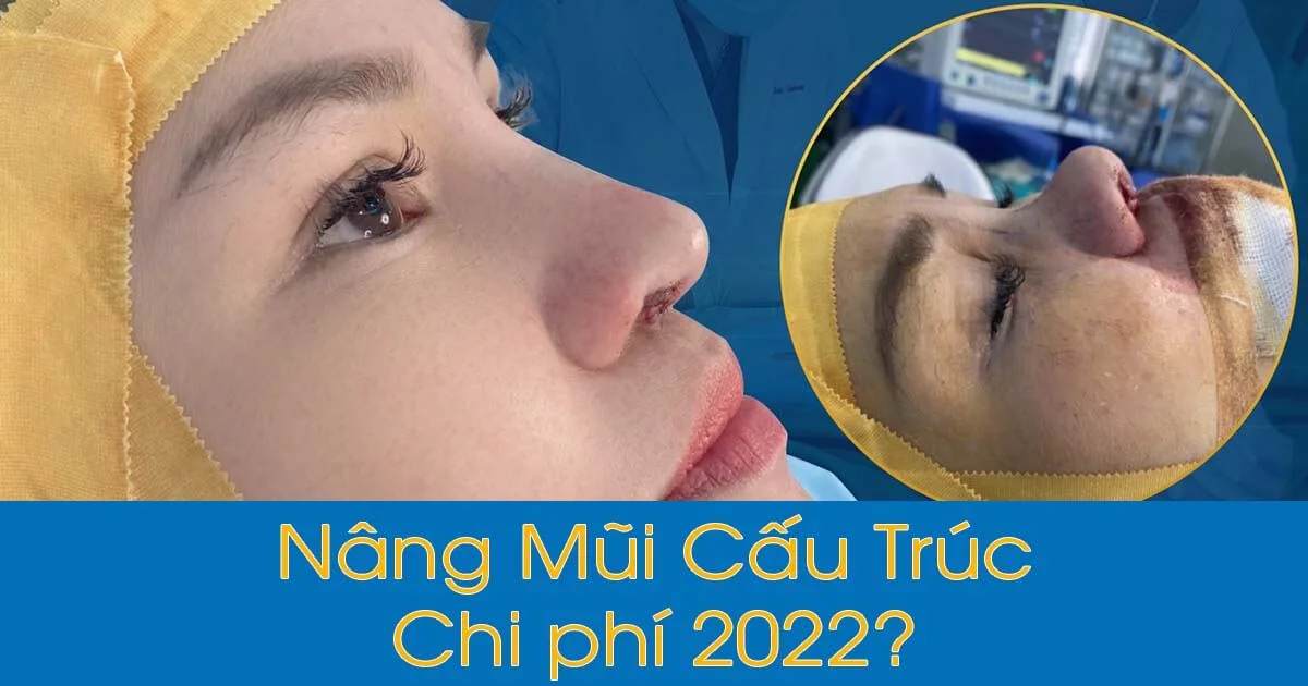 Nâng mũi Cấu trúc là gì? Chi phí 2022