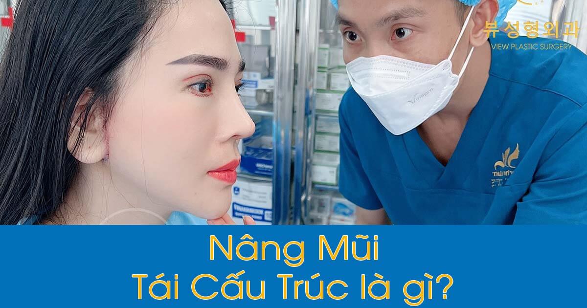 Nâng mũi tái cấu trúc