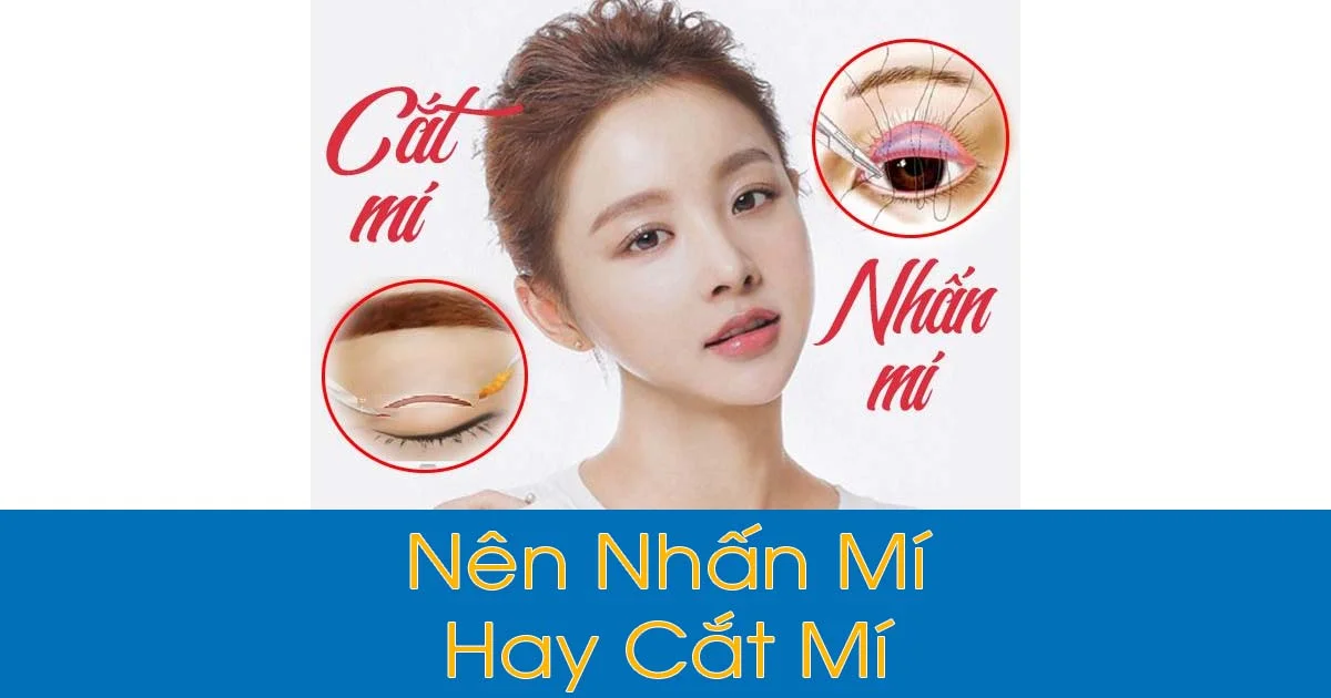 Nên Nhấn mí hay cắt mí
