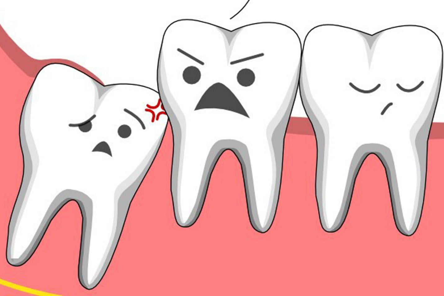 vệ sinh răng miệng sau khi nhổ răng khôn tốt