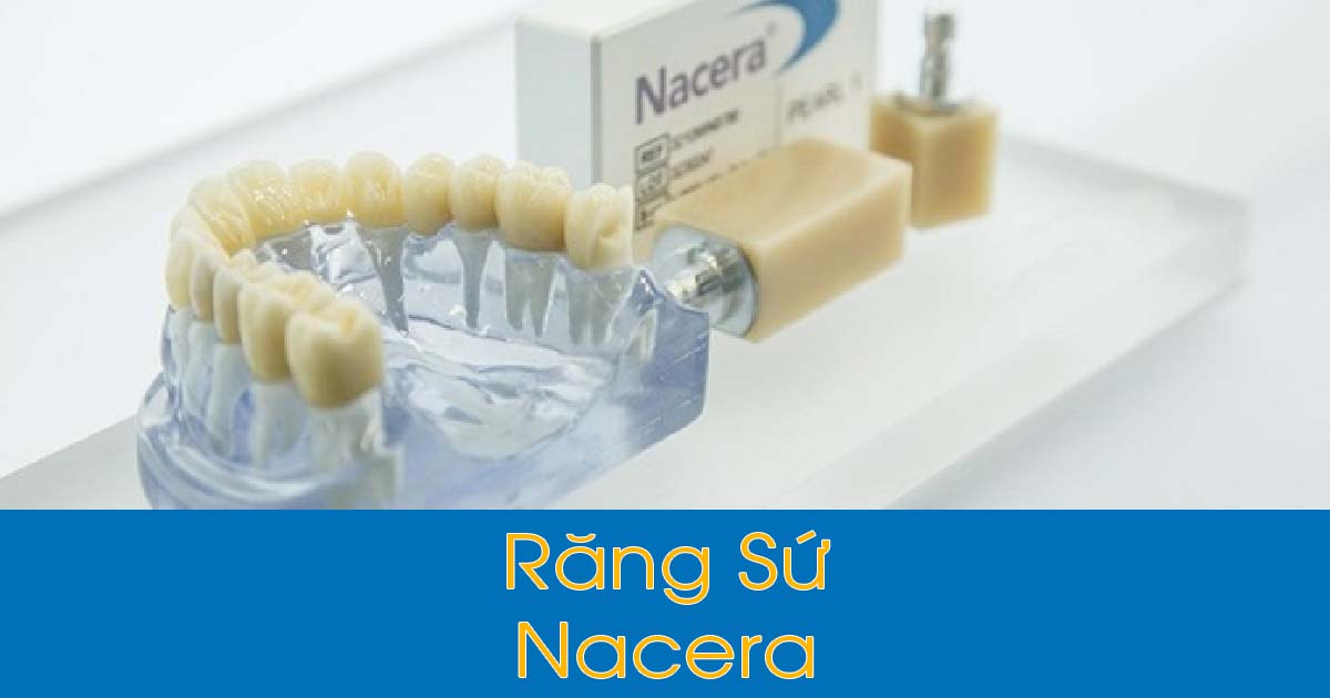 Răng sứ Nacera có tốt không?