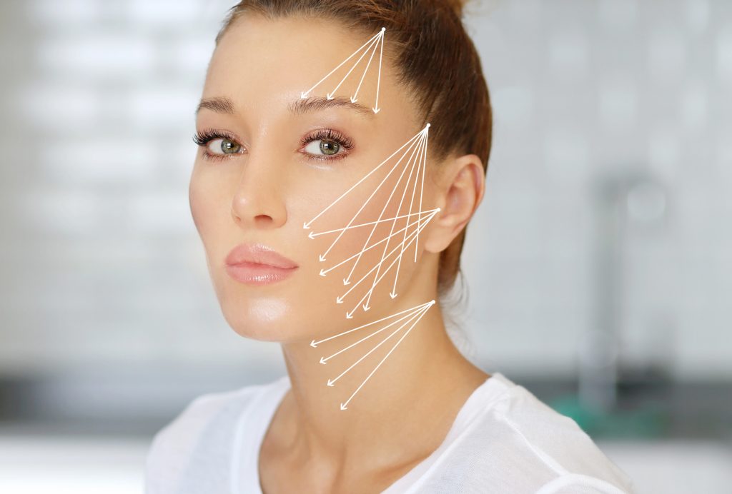 Căng chỉ collagen