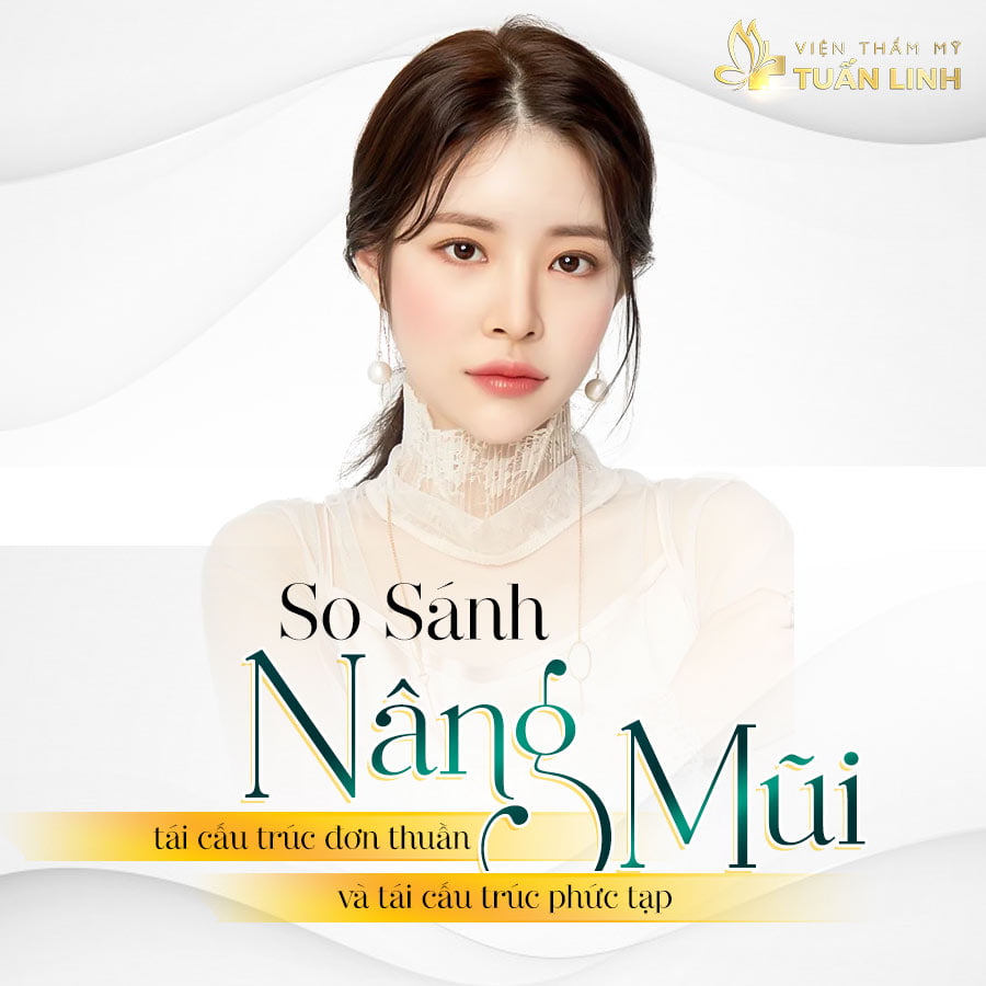 so-sanh-tai-cau-truc-don-thuan-va-tct-phuc-tap