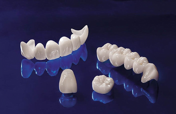 Răng sứ kim loại