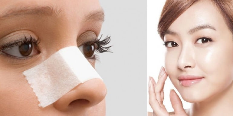 nâng mũi, sửa mũi, sửa mũi hỏng-12