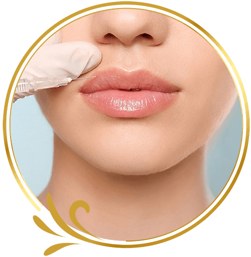 Phẫu thuật thẩm mỹ tiêm Filler