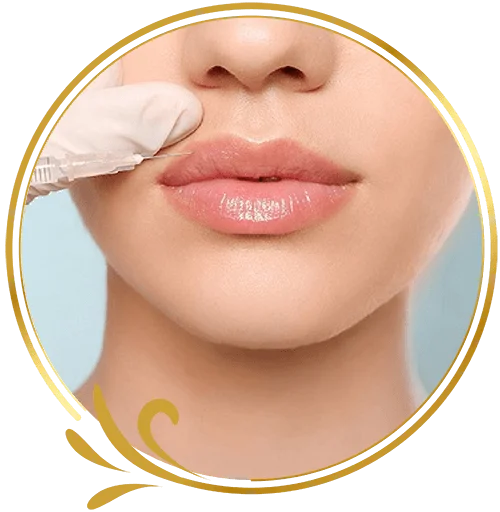 Phẫu thuật thẩm mỹ tiêm Filler