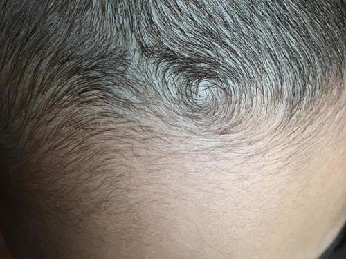 Cha mẹ xem xoáy tóc đỉnh đầu đoán định tương lai con trẻ