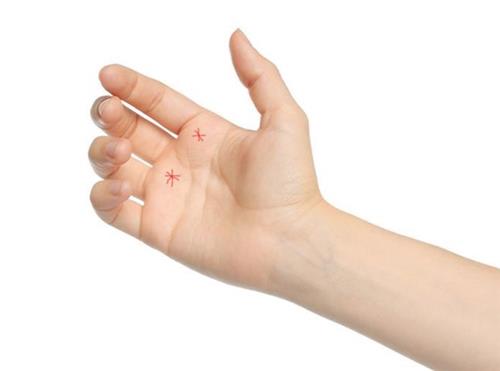 Lòng bàn tay nhiều vân hình sao