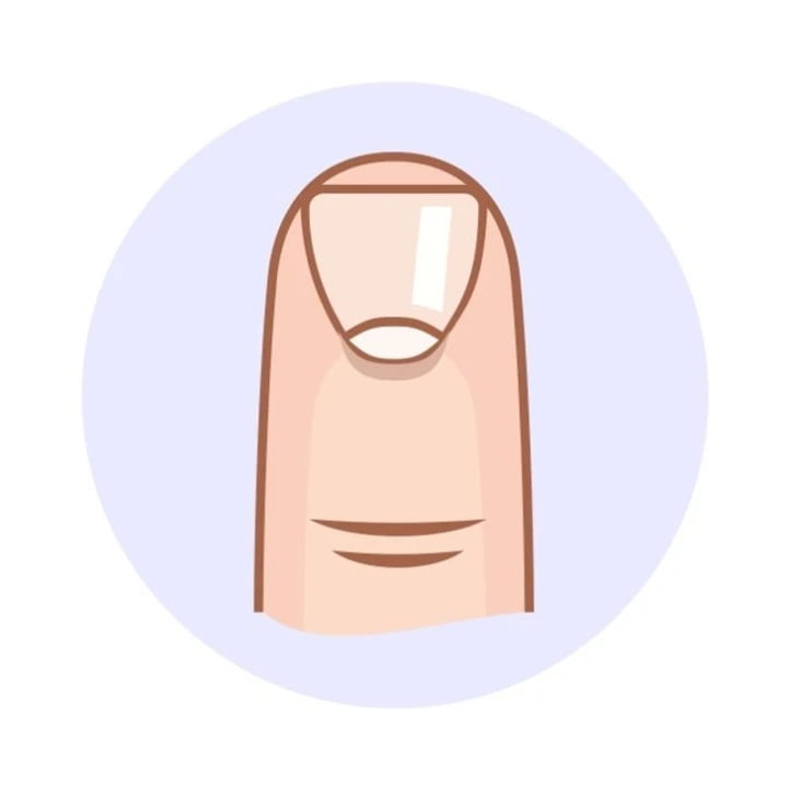 Móng tay hình tam giác