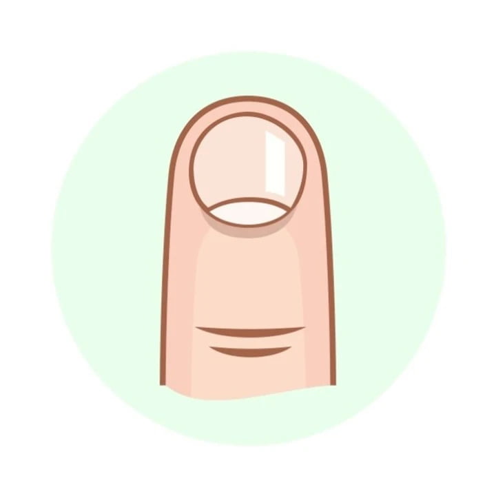 Móng tay hình tròn trắng