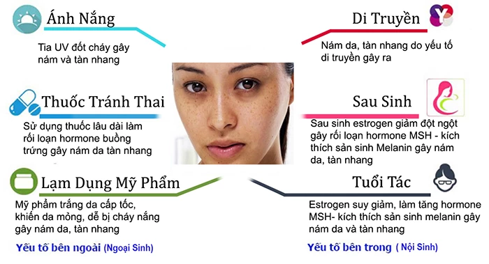 Nguyên nhân gây ra tàn nhang
