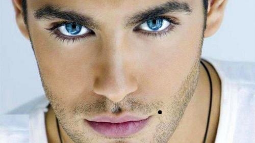 nốt ruồi cách mép 1 cm