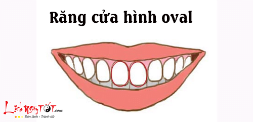 Tướng răng cửa hình oval