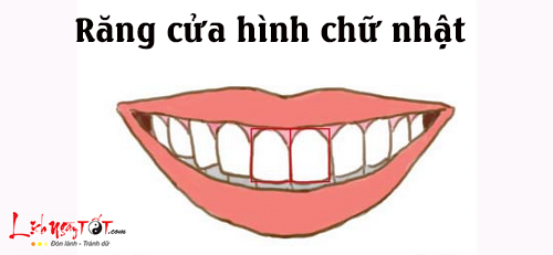 Tướng răng cửa hình chữ nhật
