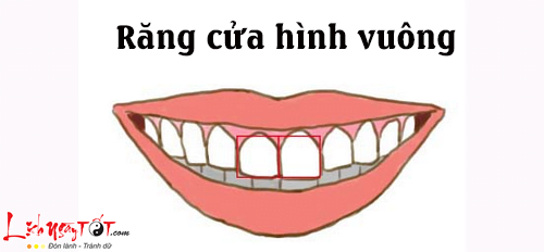 Tướng răng cửa hình vuông